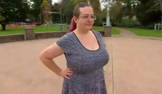 女子胸部太大的烦恼：结果去做缩胸手术