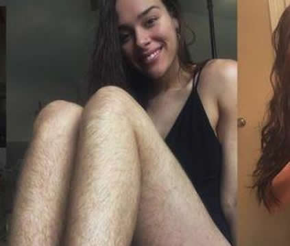 女子体毛旺盛一年不刮：如今晒出的照片（图）