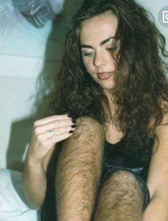 女子体毛旺盛一年不刮：如今晒出的照片（图）