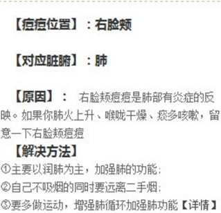 长痘痘的位置图解：痘痘位置不同反应不同脏腑情况