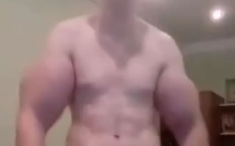 男子长出麒麟臂:或与不当拔罐有关(图) 男子长出麒麟臂:或与不当拔罐有关(图)