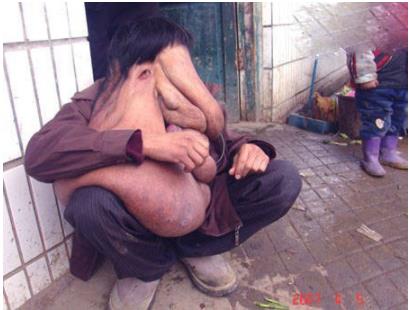 最恶心的图片集合:世界上又丑又恶心的男人和女人 最恶心的图片集合:世界上又丑又恶心的男人和女人