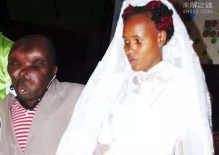 最恶心的图片集合：世界上又丑又恶心的男人和女人