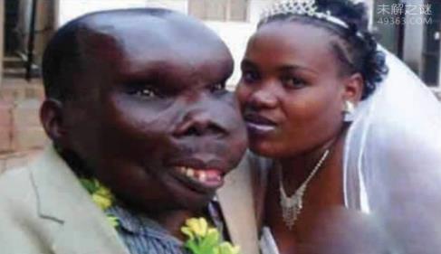 最恶心的图片集合：世界上又丑又恶心的男人和女人