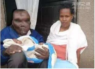 最恶心的图片集合：世界上又丑又恶心的男人和女人