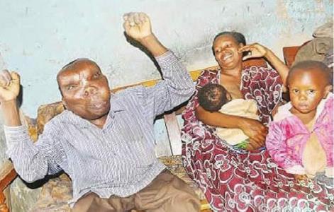 最恶心的图片集合：世界上又丑又恶心的男人和女人