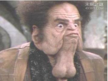 最恶心的图片集合：世界上又丑又恶心的男人和女人