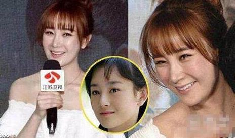 张檬整容前后照片：自然的笑容都没有了（组图）