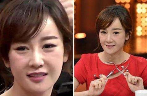 张檬整容前后照片：自然的笑容都没有了（组图）