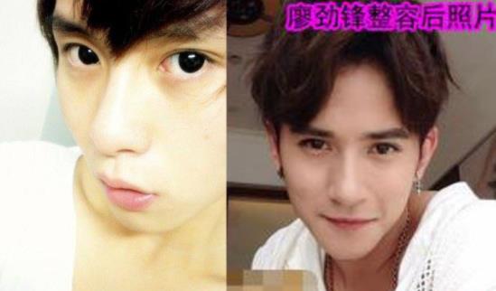 校草廖劲锋疑似整容：廖劲锋整容了吗（有图）