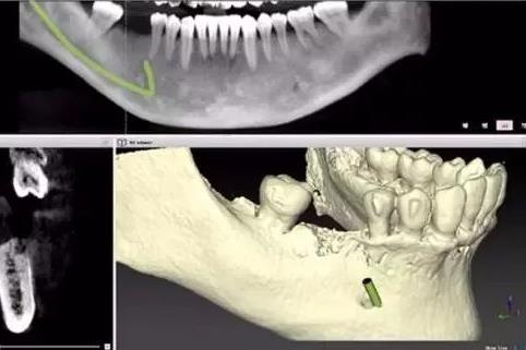 一个牙医的良心忠告:句句真理真实但很实用(图) 一个牙医的良心忠告:句句真理真实但很实用(图)