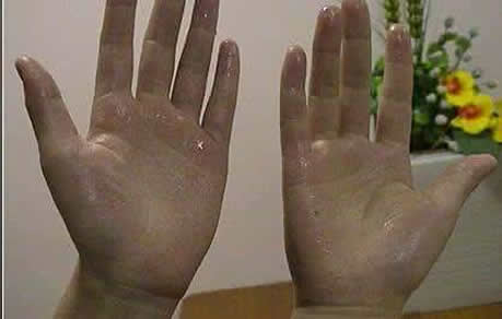 容易出汗是排毒?容易出汗可能是这几种疾病的前兆 容易出汗是排毒?容易出汗可能是这几种疾病的前兆