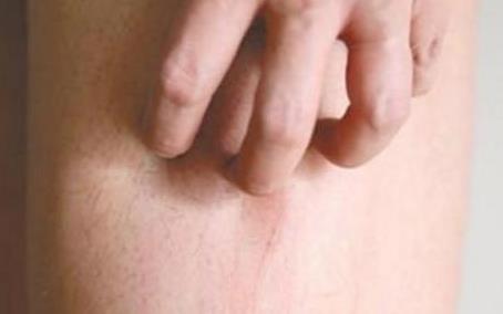 女人这里再痒也千万别用手抓：警惕抓了更严重