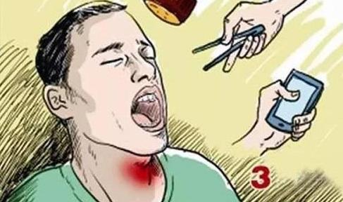 鱼刺卡到喉咙!救了100万人的方法!建议收藏 鱼刺卡到喉咙!救了100万人的方法!建议收藏