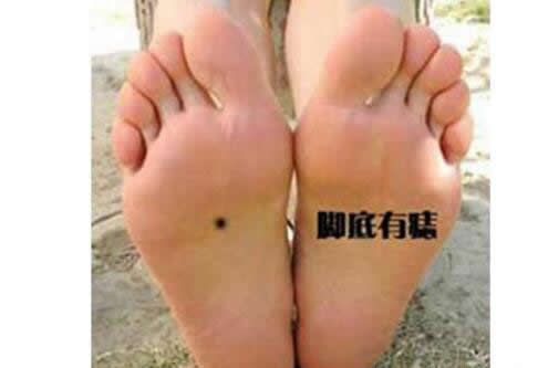 脚底下有这3种特征的人,十人有九富（图）