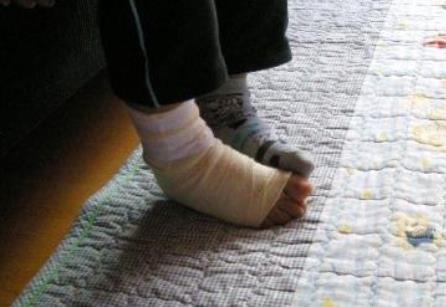 脚崴了肿了怎么消肿:解决崴脚肿痛的办法 脚崴了肿了怎么消肿:解决崴脚肿痛的办法