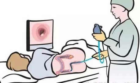 隐血是什么意思:大便有隐血可能是什么怎么办 隐血是什么意思:大便有隐血可能是什么怎么办