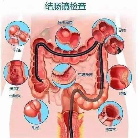 隐血1十