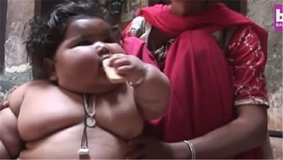 女婴每天吃48顿饭：该怎么办一岁女婴体重达50斤