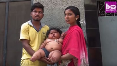 女婴每天吃48顿饭：该怎么办一岁女婴体重达50斤