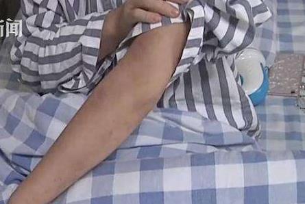 女子反复高烧两个月:成人Still病你听说过吗? 女子反复高烧两个月:成人Still病你听说过吗?