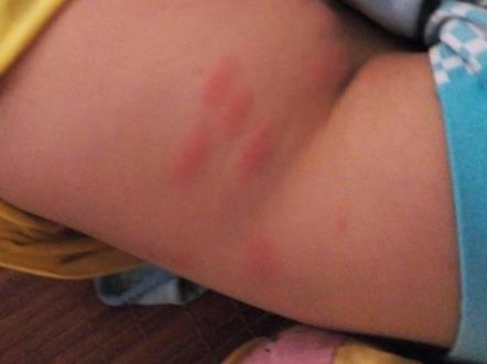 跳蚤怎么消灭:家里来了跳蚤经验分享 跳蚤怎么消灭:家里来了跳蚤经验分享