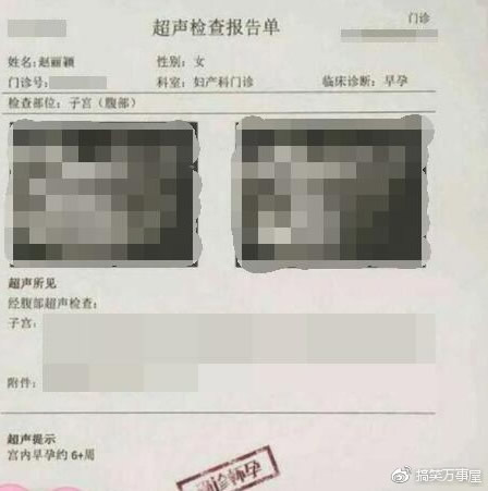 赵丽颖方回应B超照：因B超检查报告图重名被怀孕