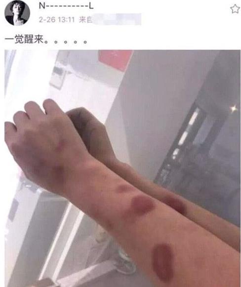 黄景瑜回应家暴:有没有家暴是什么情况揭开(图) 黄景瑜回应家暴:有没有家暴是什么情况揭开(图)