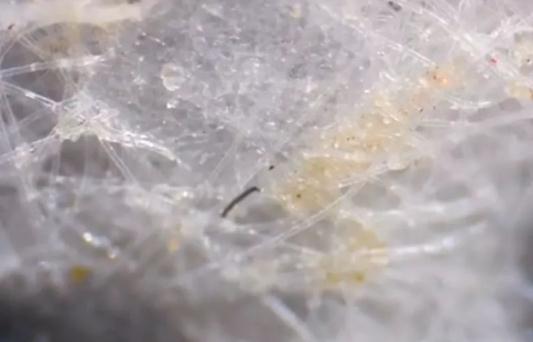 世界上让人恶心的图片：震撼不可思议各式各样