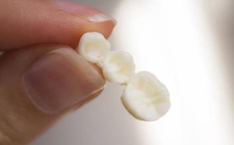 饭菜吃出一排假牙:让人倒胃口,事情来龙去脉揭晓 饭菜吃出一排假牙:让人倒胃口,事情来龙去脉揭晓