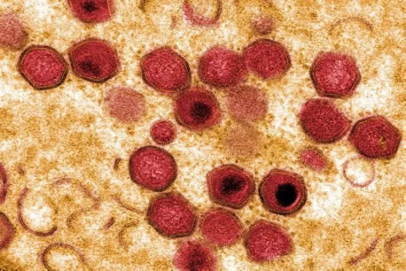 双汇回应非洲猪瘟:什么是非洲猪瘟?危害有哪些 双汇回应非洲猪瘟:什么是非洲猪瘟?危害有哪些