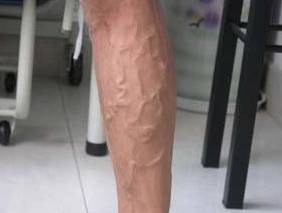 天天泡脚是养生还是慢性自杀?(泡脚禁忌)