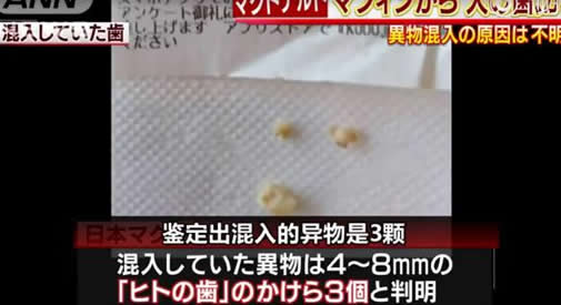 日本麦当劳男子吃出3颗牙：真相查不出（细致极恐）