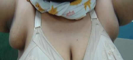 初中男生患女乳症：被嘲笑胸部(图)