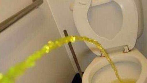 排尿很黄、异味很大?身体在向你暗示这5件事!（图）