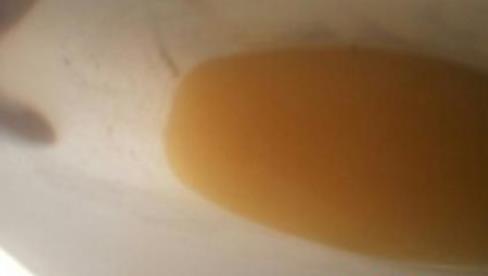 排尿很黄、异味很大?身体在向你暗示这5件事!（图）