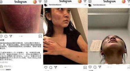 日本 蒋劲夫家暴：中浦悠花日本电视台指控蒋劲夫家暴始末