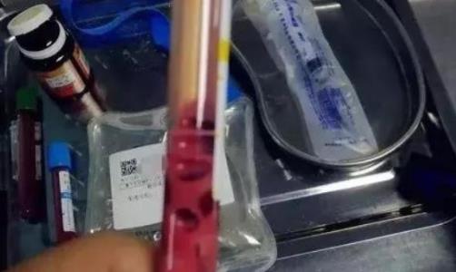 少女血液变粉红色是怎么回事：解读血液变粉红的详情