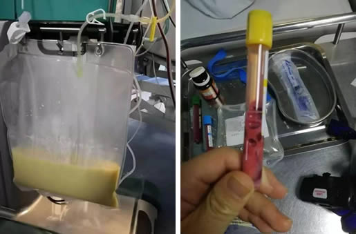 因一个习惯少女血液变粉红色：从鬼门关走一遭让人心疼