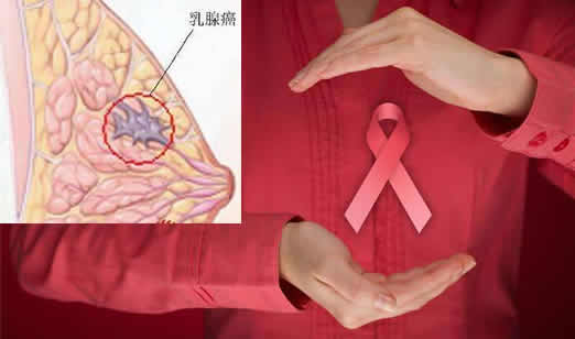 3岁小女孩乳腺癌是什么情况：怎么小得乳腺癌详情真相