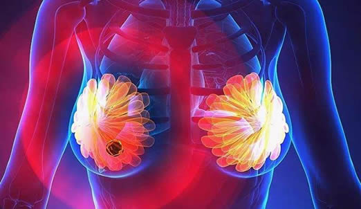 3岁小女孩乳腺癌是什么情况：怎么小得乳腺癌详情真相