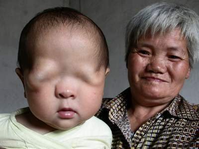 世界恐怖的52种怪病盘点：有些匪夷所思有些细致极恐