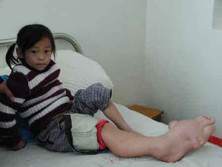 世界恐怖的52种怪病盘点：有些匪夷所思有些细致极恐