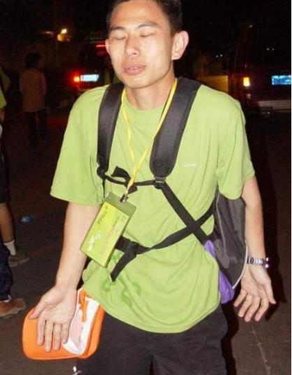 世界恐怖的52种怪病盘点：有些匪夷所思有些细致极恐