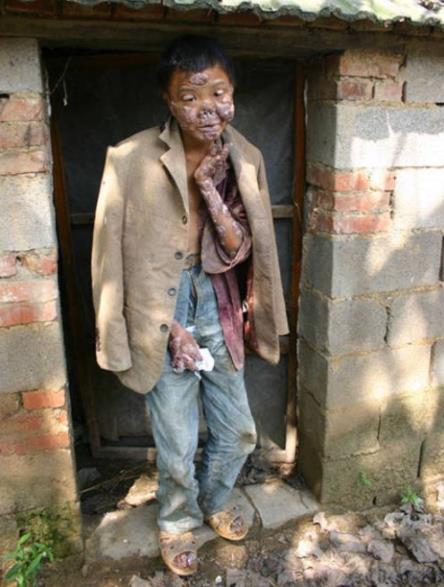 世界恐怖的52种怪病盘点：有些匪夷所思有些细致极恐