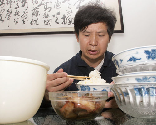 世界恐怖的52种怪病盘点：有些匪夷所思有些细致极恐