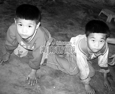 世界恐怖的52种怪病盘点：有些匪夷所思有些细致极恐