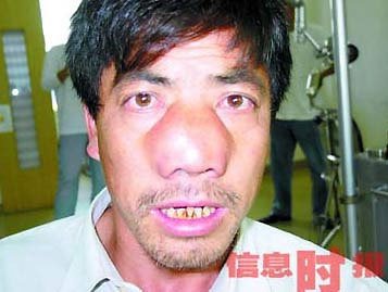 世界恐怖的52种怪病盘点：有些匪夷所思有些细致极恐