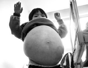 世界恐怖的52种怪病盘点：有些匪夷所思有些细致极恐