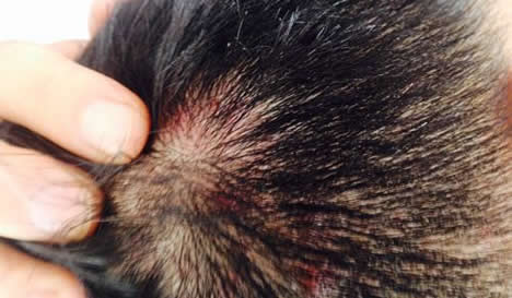 头上长疙瘩是什么情况：分析原因教你该怎么办